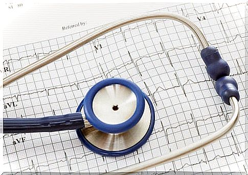 Unusual causes of palpitations such as past heart disease