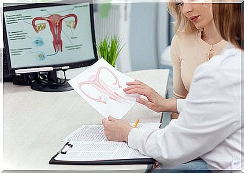 Ovarian cysts should be diagnosed by a doctor