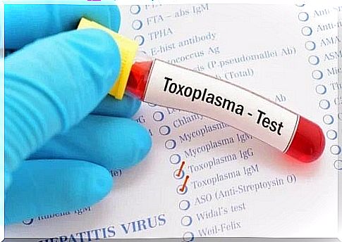 Necessary tests in the treatment of ocular toxoplasmosis