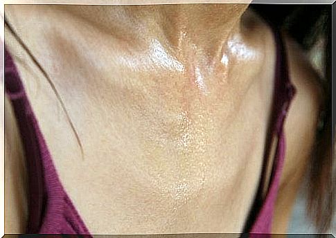 Excessive sweating can be overcome with various natural remedies