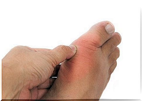 Gout and uric acid - a natural treatment