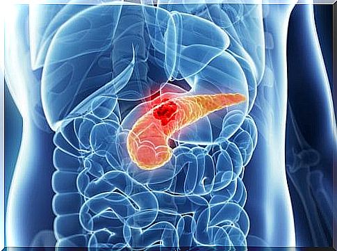 The first hormonal symptoms of pancreatic cancer