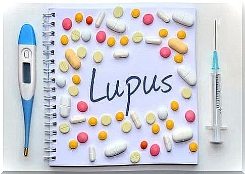 Medicines for lupus in pregnancy