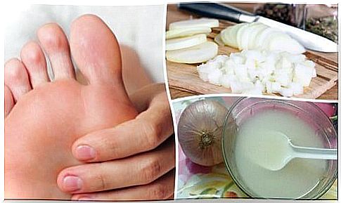 Natural treatment for thickened skin on the soles