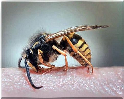 Remedies for wasp stings