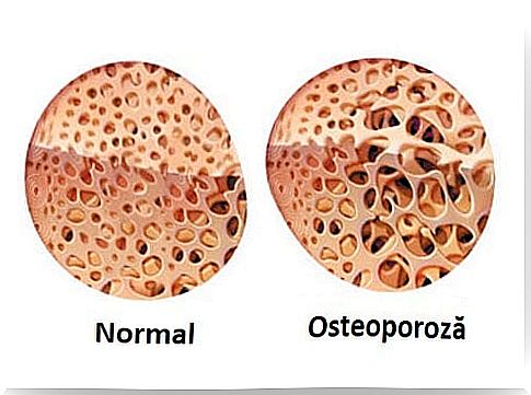 Ways to treat Crohn's disease that can cause side effects