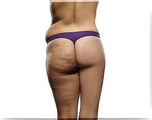 The most effective anti-cellulite diet plan