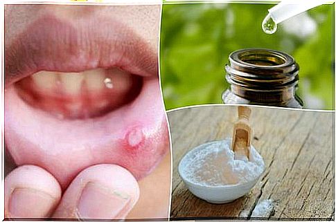 Treat canker sores with 6 natural remedies