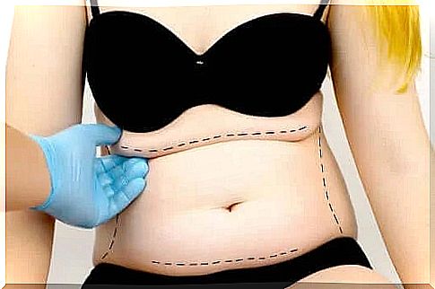 What is tummy tuck?